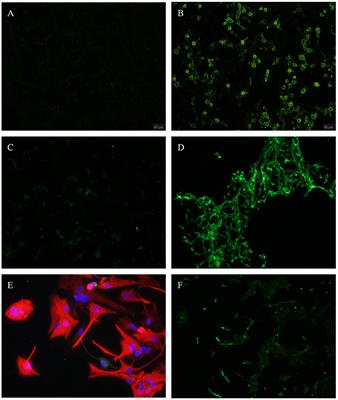 Immunity in Gilles de la Tourette-Syndrome: Results From a Cerebrospinal Fluid Study